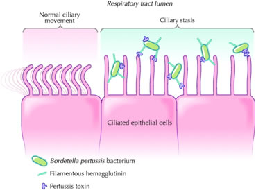 bordetella pertussis