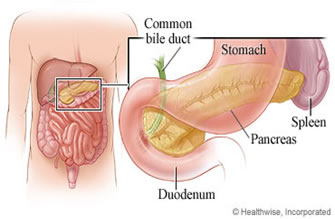 Cause Pancreatite