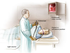 diagnosi ulcera stomaco