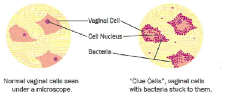 Diagnosi Vaginosi