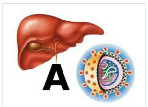 Virus Epatite A