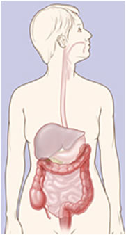 Morbo di Crohn