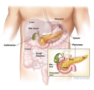 pancreatite