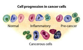 pap- test cellule tumorali cervice