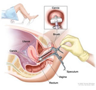 Pap Test