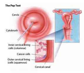 Pap Test Risultati