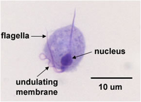 tricomoniasi Trichomonas vaginalis